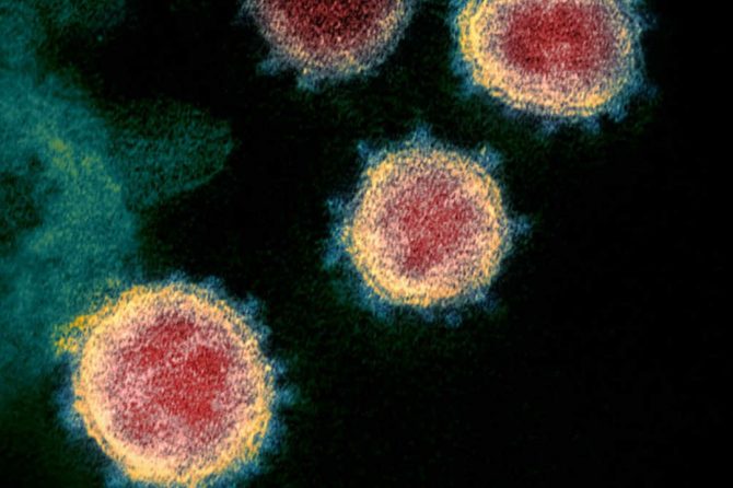 Coronavirus: Todo lo que debe saber
